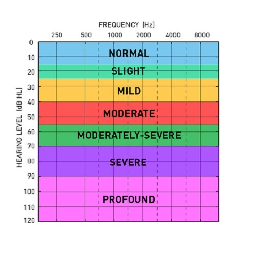 audiogram chart color coded Pusat Alat Bantu Dengar Indonesia - Brilliant Hearing Cara Membaca Audiogram serta Pengertian Audiogram